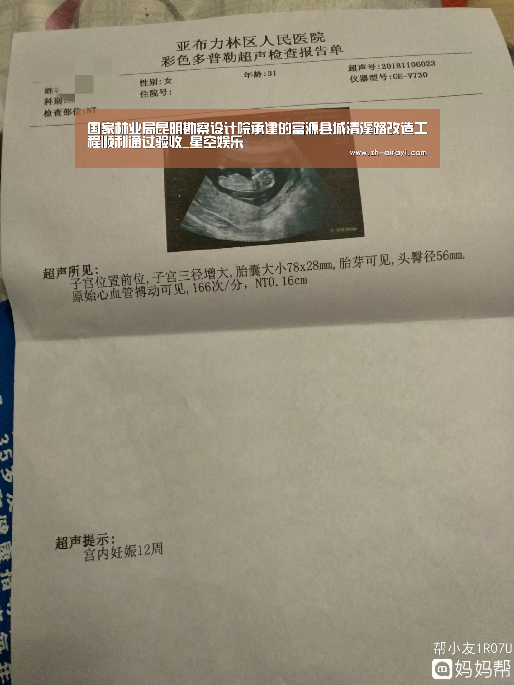 国家林业局昆明勘察设计院承建的富源县城清溪路改造工程顺利通过验收_星空娱乐(图2) 星空娱乐